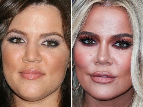 chloe before plastic surgery|khloe kardashian before surgery.